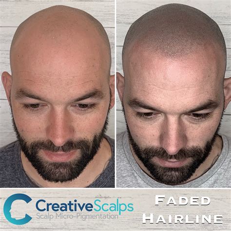 scalp micropigmentation albuquerque|TOP 10 BEST Scalp Micropigmentation (SMP) in Albuquerque, .